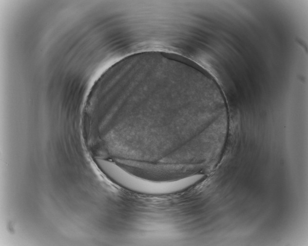X0000098151144200805151158