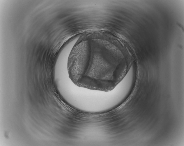 X0000098151161200805151158
