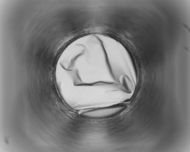 X0000098151166200805151158