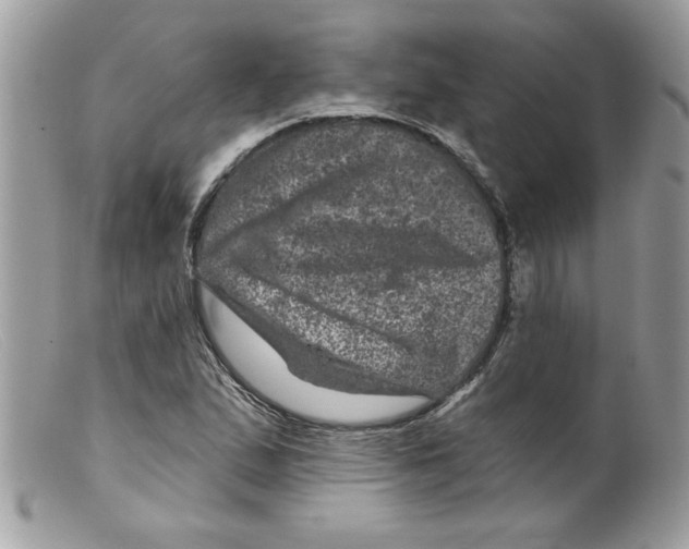 X0000098151167200805151158