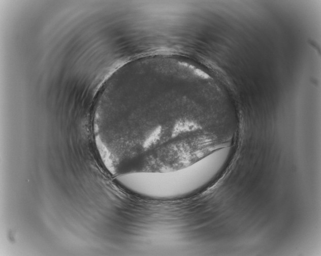 X0000098151170200805151157