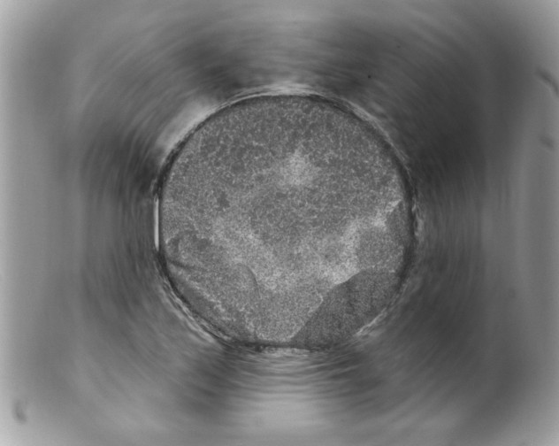 X0000098151171200805151157