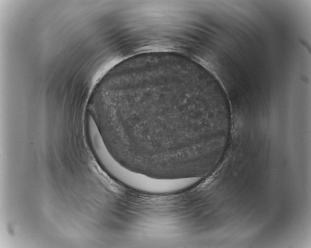 X0000098151179200805151157