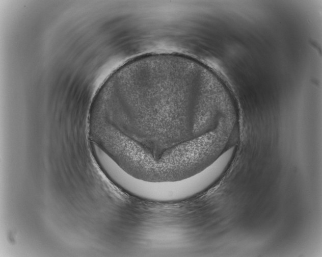 X0000098151183200805151157