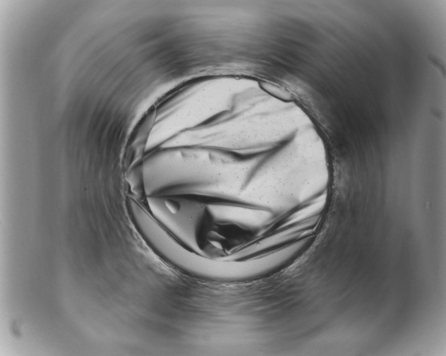 X0000098151184200805151157