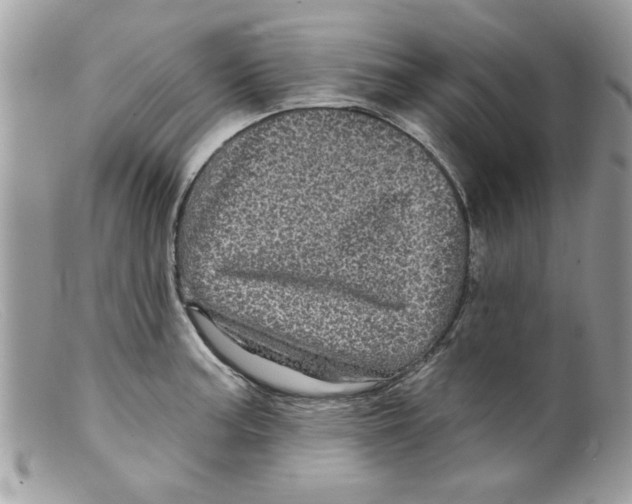 X0000098151187200805151157