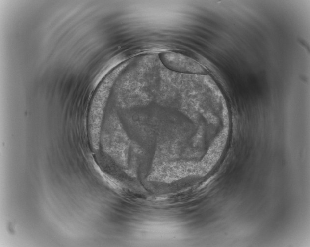 X0000098151194200805151157