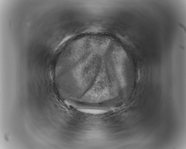 X0000098151206200805151156