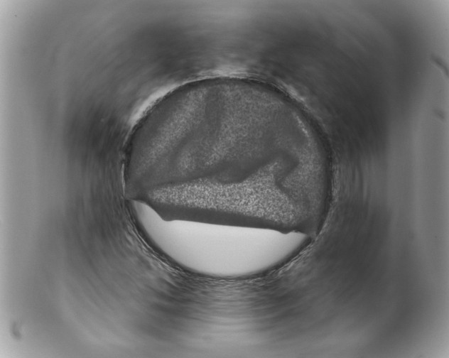 X0000098151214200805151156