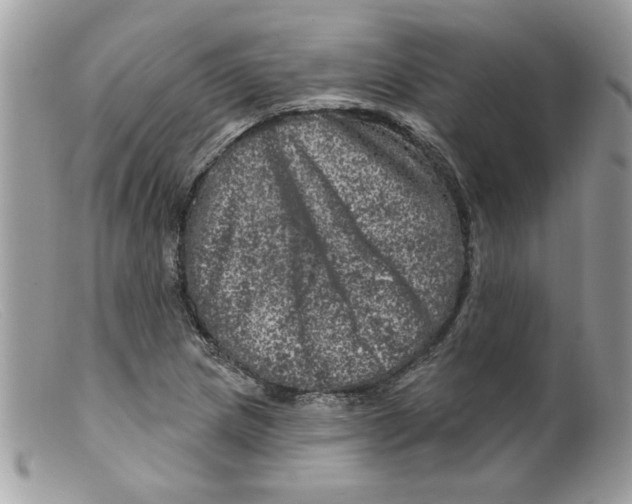 X0000098151217200805151156