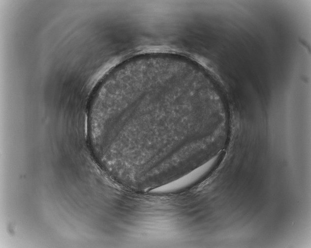 X0000098151221200805151156