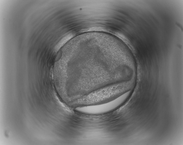 X0000098151241200805151157