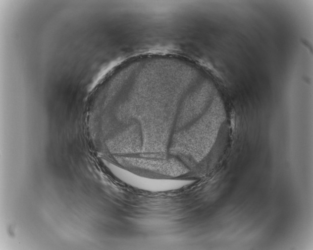 X0000098151256200805151156