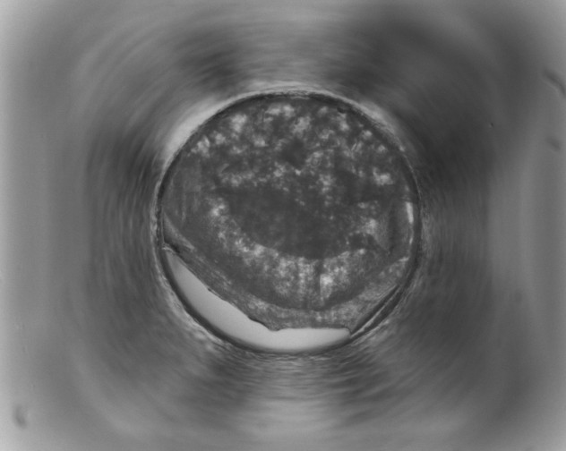 X0000098151279200805151156