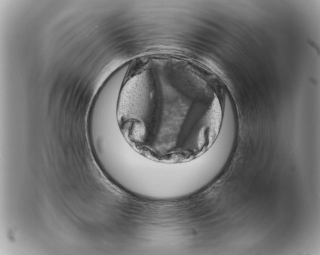 X0000098151283200805151156