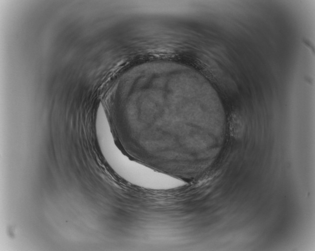 X0000098151298200805151155