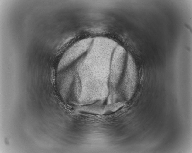 X0000098151301200805151155