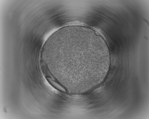 X0000098151387200805151154
