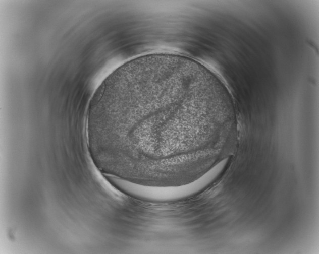 X0000098151391200805151154