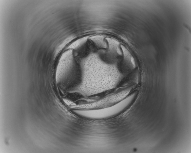 X0000098151410200805151153