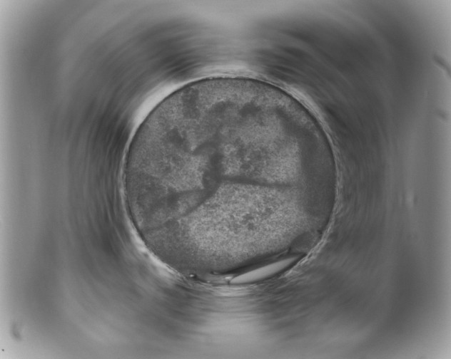 X0000098151440200805151154