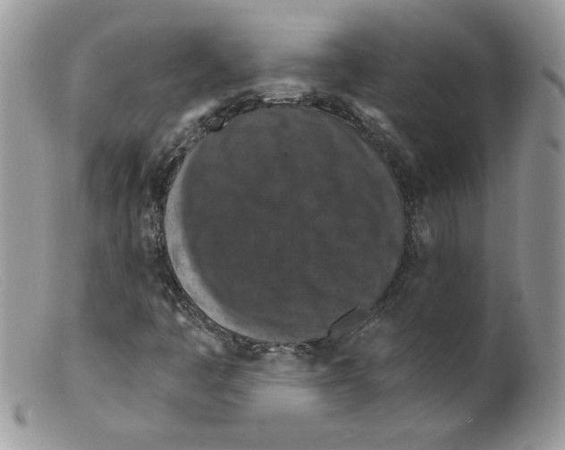 X0000098151445200805151153