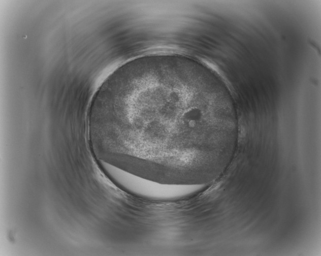 X0000098151467200805151153