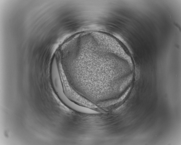 X0000098151477200805151153