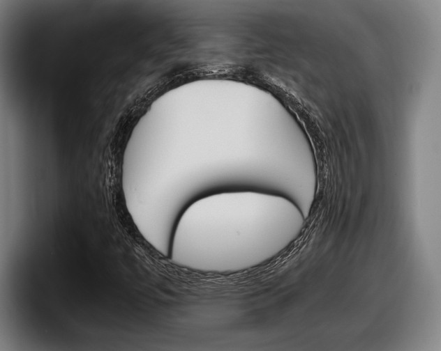 X0000098161447200804171207