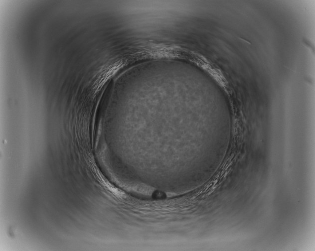 X0000098160009200804171611