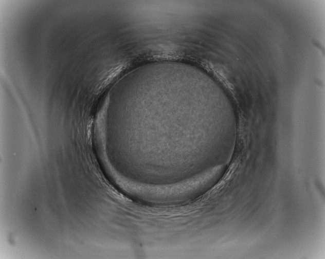X0000098160017200804171611