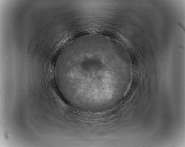 X0000098160043200804171610