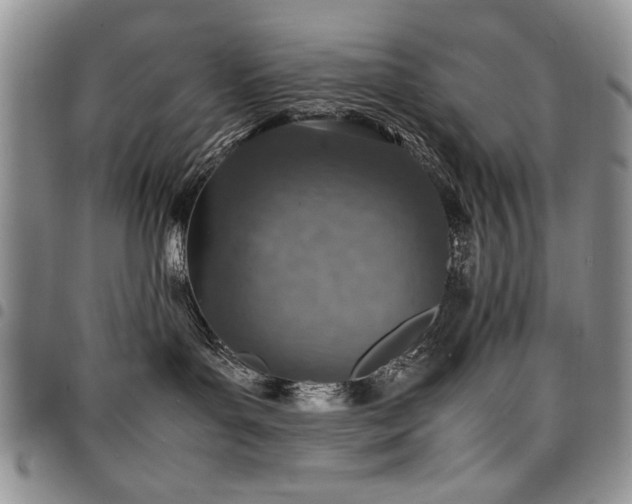 X0000098160143200804171608
