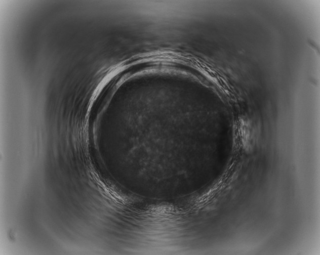 X0000098160200200804171607