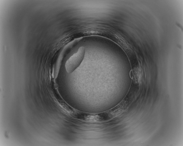 X0000098160410200804171604