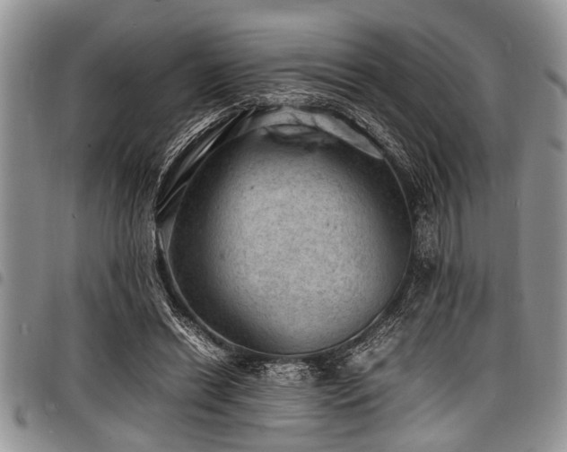 X0000098160446200804171603