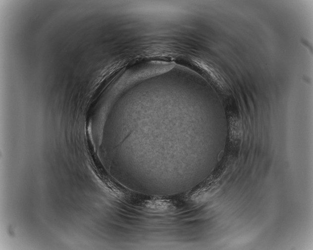X0000098160451200804171603