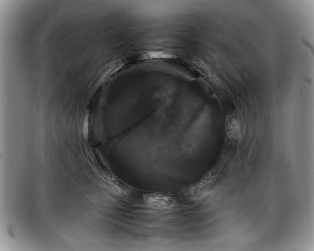 X0000098160471200804171604