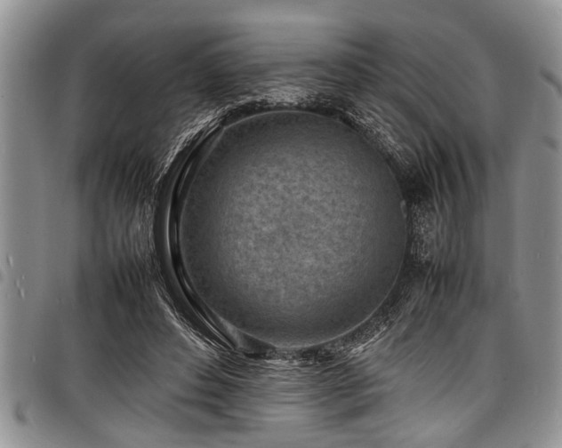 X0000098160496200804171603