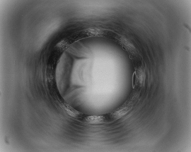 X0000098160526200804171602