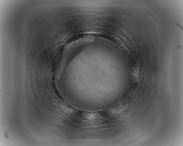 X0000098160663200804171601