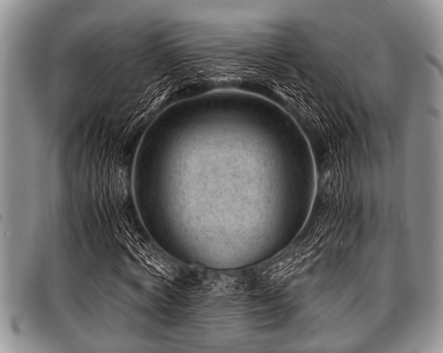 X0000098160772200804171558