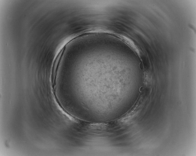 X0000098160863200804171557