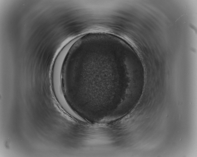 X0000098160864200804171557