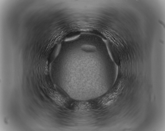 X0000098160916200804171555