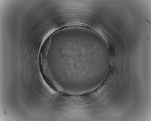 X0000098160995200804171554