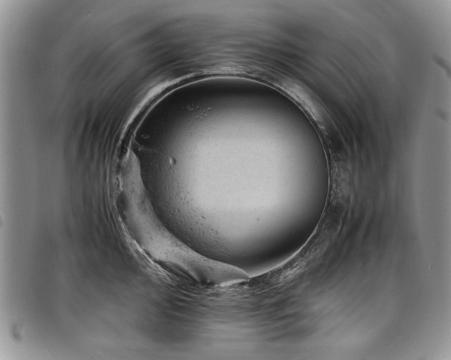 X0000098161000200804171554