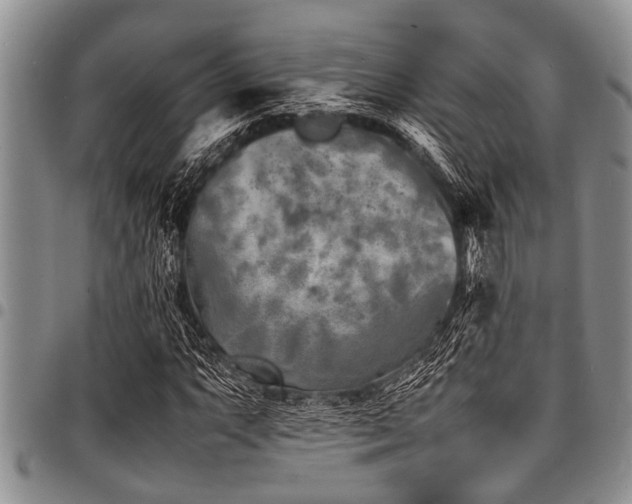 X0000098161063200804171553
