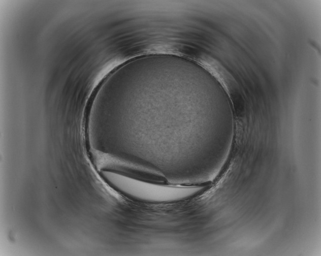 X0000098161141200804171552