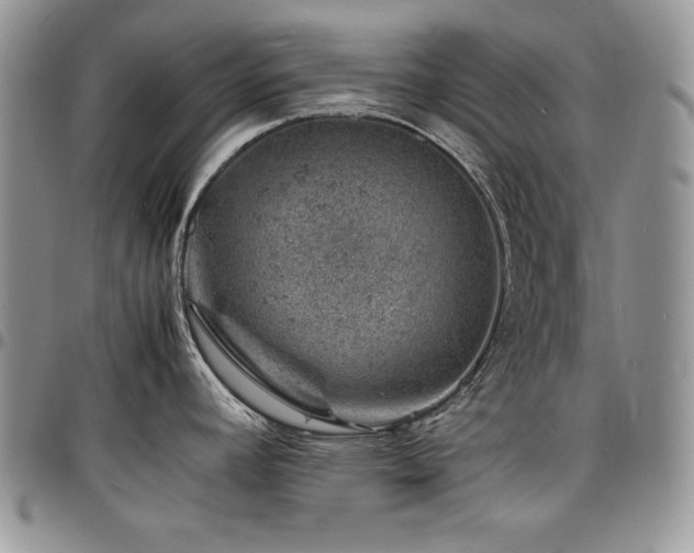 X0000098161392200804171548